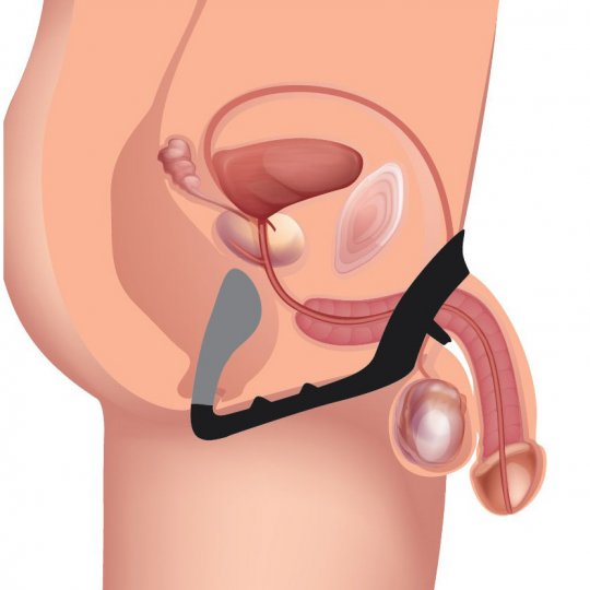 Excursion Silicone Triple Stim Anal Plug with Cock and Ball Ring - SP BOUTIQUE